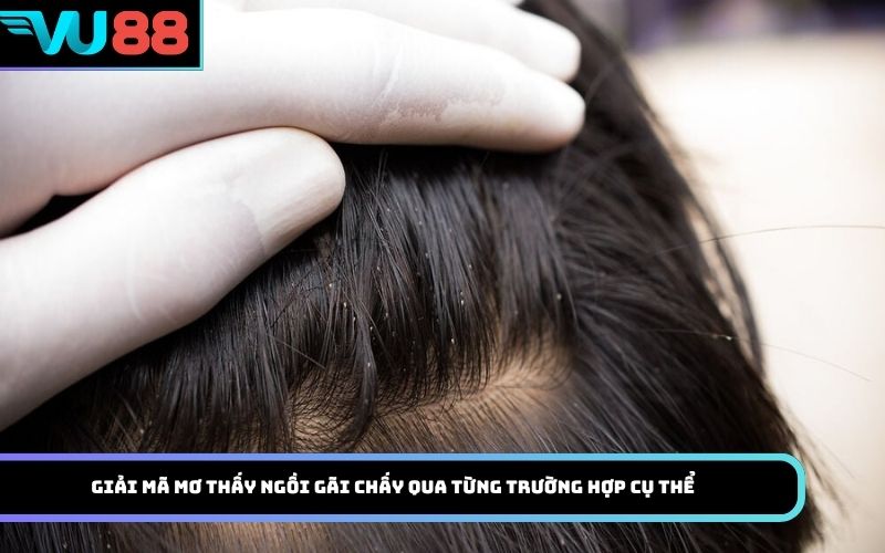 Giải mã mơ thấy Ngồi gãi chấy qua từng trường hợp cụ thể