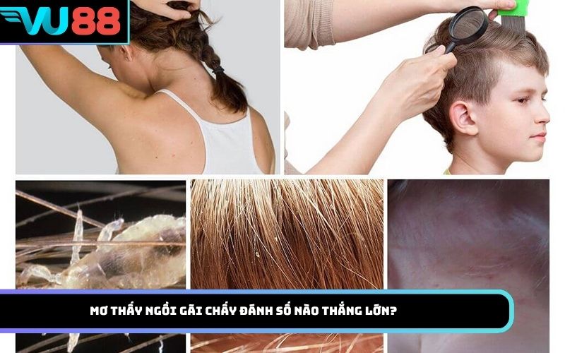 Mơ thấy Ngồi gãi chấy đánh số nào thắng lớn?
